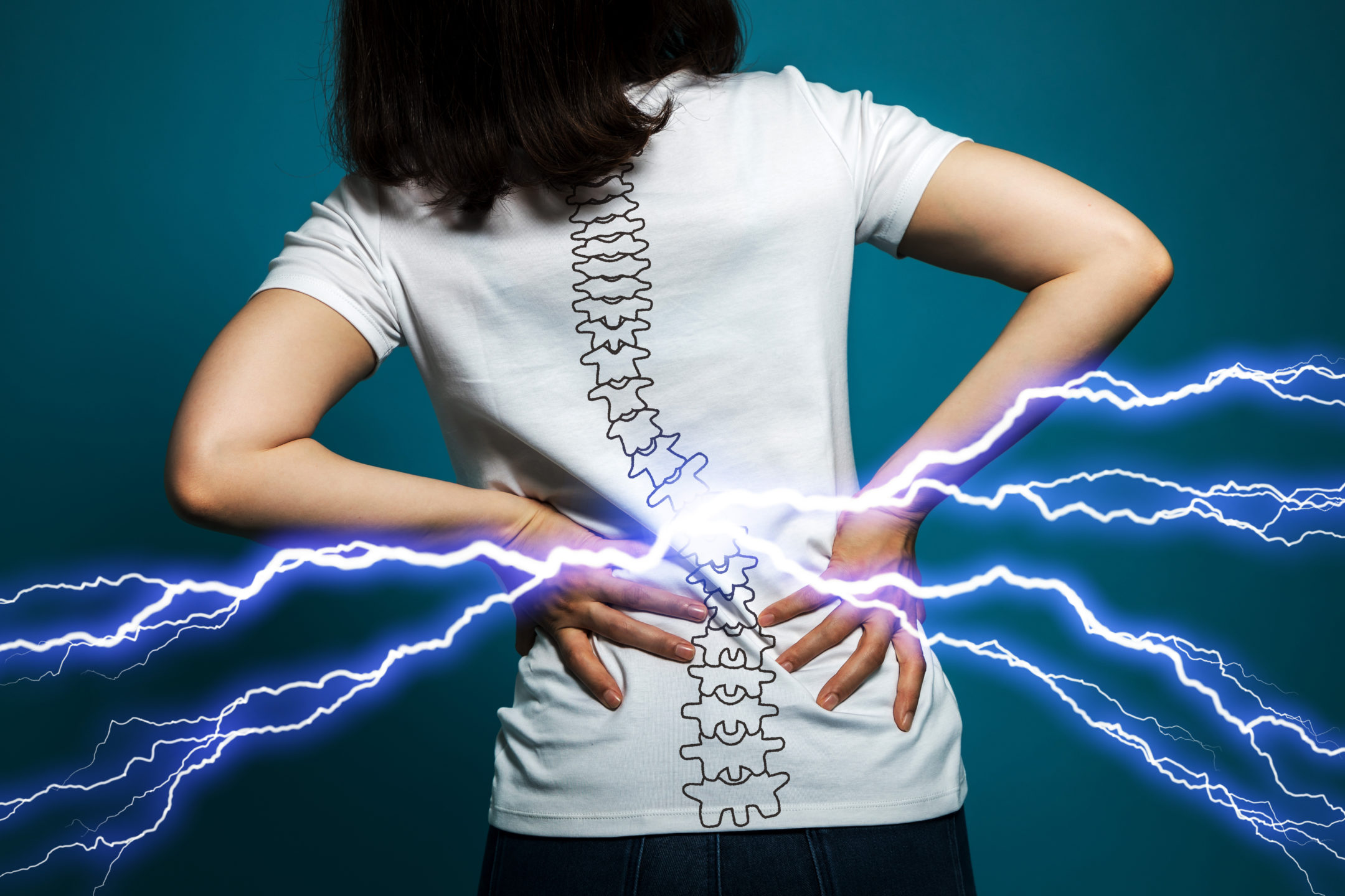 Back view of a woman who needs surgery for back pain wearing a T-shirt with a backbone sketch and lightning bolts of pain.