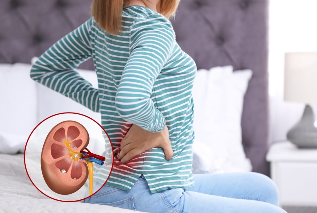 How To Sleep for Kidney Stone Pain Relief