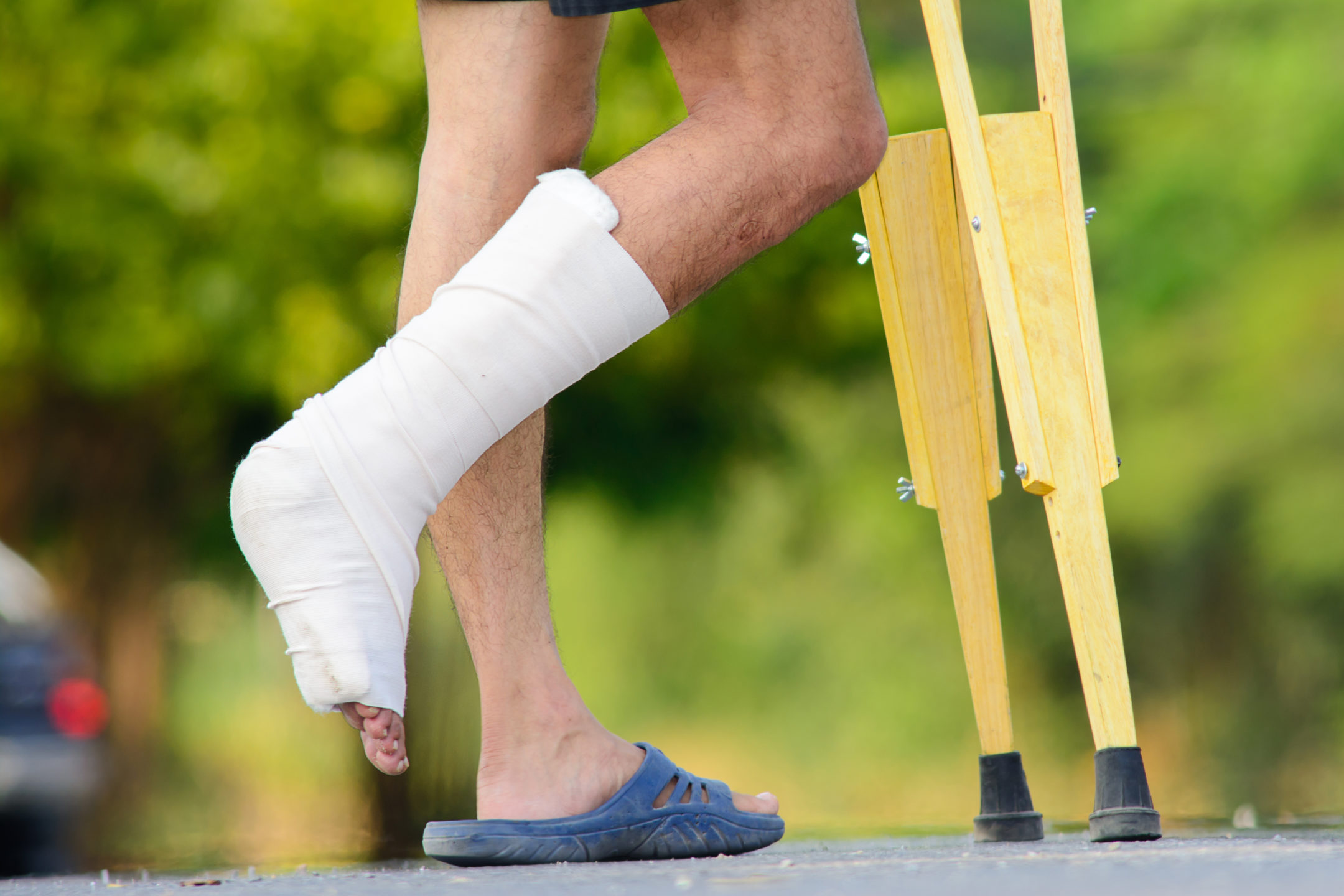  A man stands on one foot with the other in a cast as he leans on crutches. 