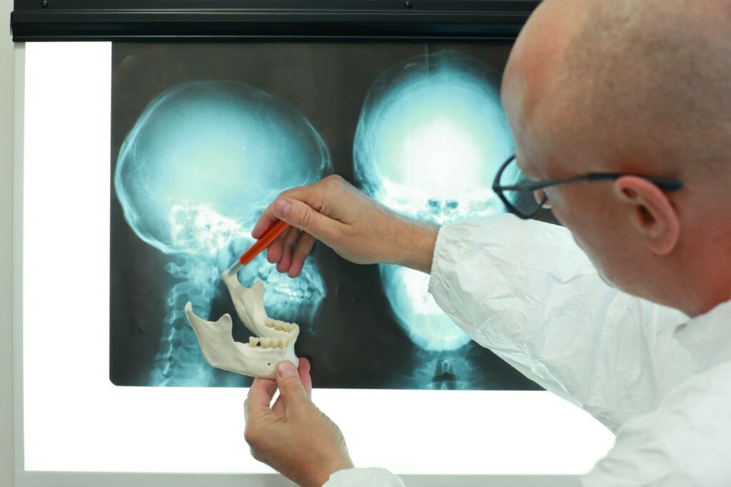 A doctor holds a model of a lower jaw up to an X-ray to show what jaw correction surgery can fix.