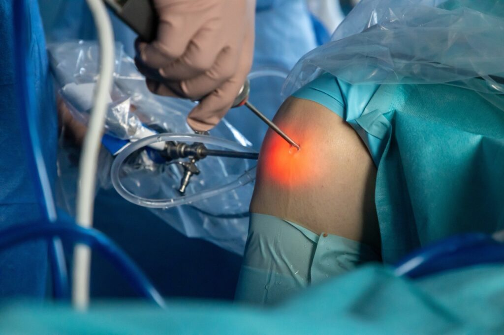 Robotic Knee Replacement: What To Expect, Cost, Recovery, & Results