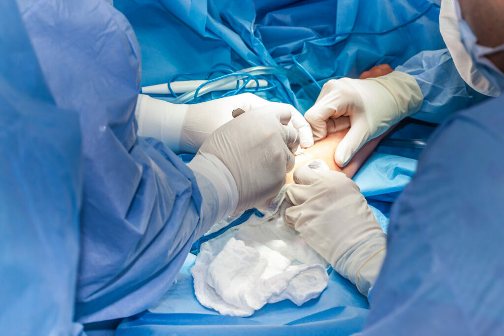 Surgeons operate on an elbow in an operating room.
